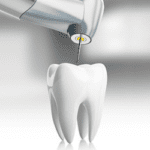 Endodontics