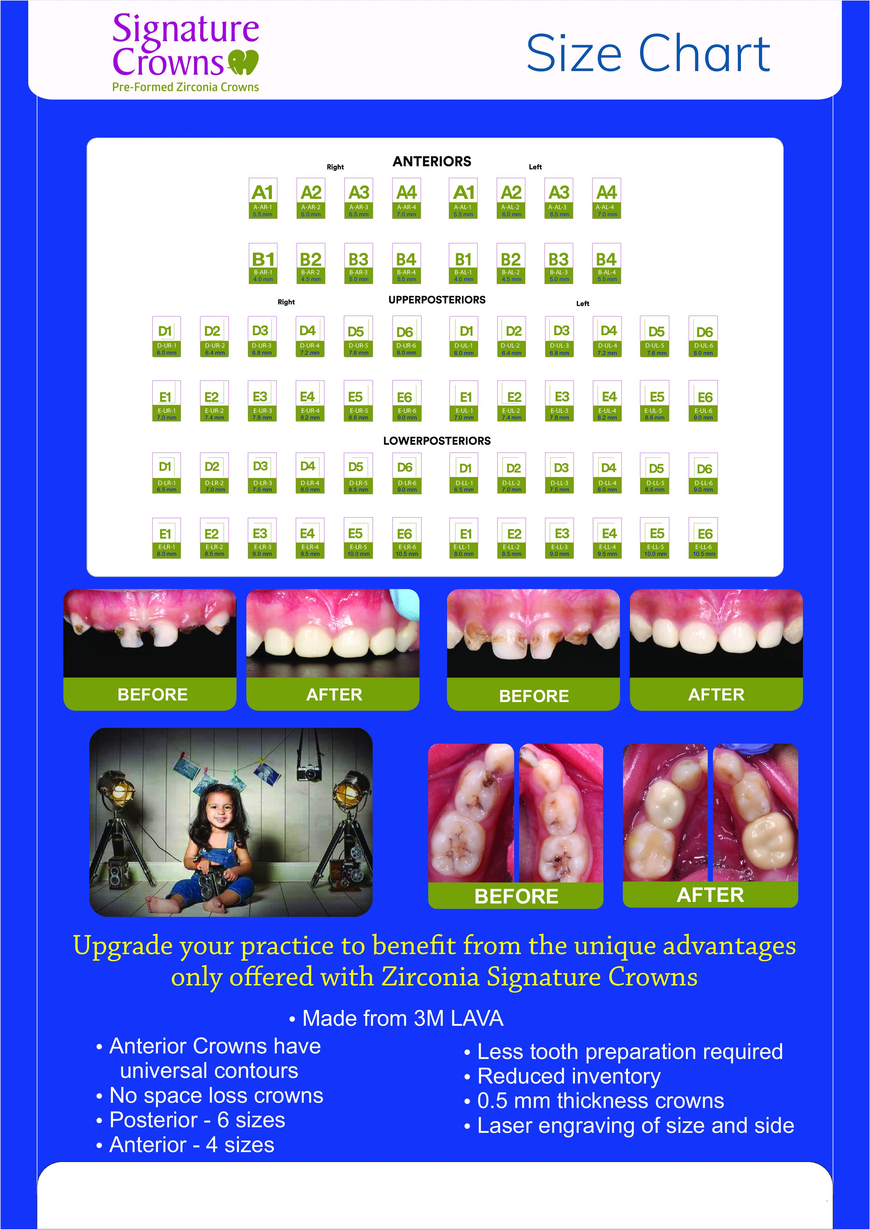 SIGNATURE PEDO ZIRCONIA CROWN KIT 1ST MOLAR 24 PCS